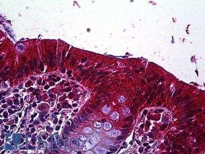 Immunohistochemistry-Paraffin: LRP-4 Antibody [NBP1-28482]