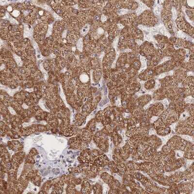 Immunohistochemistry-Paraffin: LRP-5 Antibody [NBP2-37868]