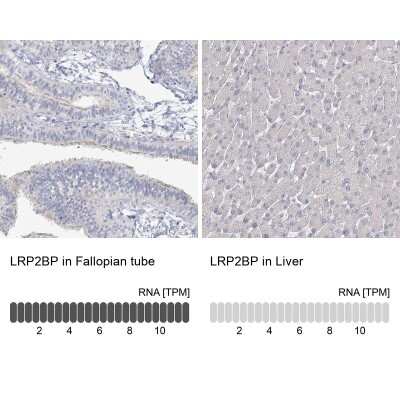 Immunohistochemistry-Paraffin: LRP2BP Antibody [NBP1-84097]