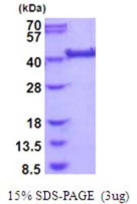 SDS-PAGE: Recombinant Human LRP2BP His Protein [NBP2-51978]