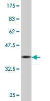 Western Blot: LRP3 Antibody (4C11) [H00004037-M10]