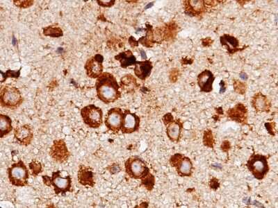 Immunohistochemistry-Paraffin: LRPAP Antibody (011) [NBP2-90514]