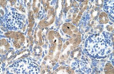 Immunohistochemistry: LRPAP Antibody [NBP1-69362]
