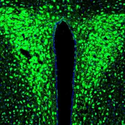 Immunohistochemistry: LRPAP Antibody [NBP1-89334]