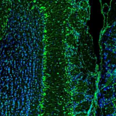 Immunohistochemistry: LRPAP Antibody [NBP1-89334]