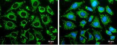 Immunocytochemistry/ Immunofluorescence: LRPPRC Antibody [NBP1-32744]