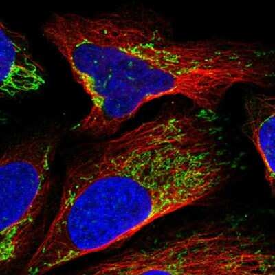 Immunocytochemistry/ Immunofluorescence: LRPPRC Antibody [NBP1-83349]