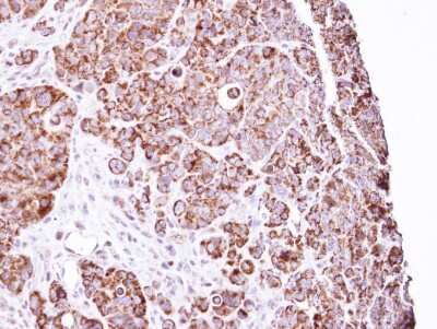 Immunohistochemistry-Paraffin: LRPPRC Antibody [NBP1-32744]