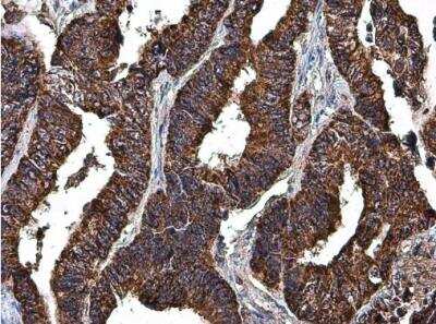 Immunohistochemistry-Paraffin: LRPPRC Antibody [NBP1-32744]