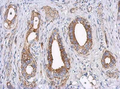 Immunohistochemistry-Paraffin: LRPPRC Antibody [NBP2-19373]