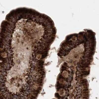 Immunohistochemistry-Paraffin: LRPPRC Antibody [NBP2-38300]