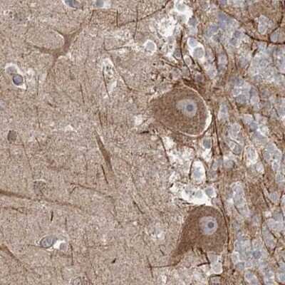 Immunohistochemistry-Paraffin: LRPPRC Antibody [NBP2-38300]