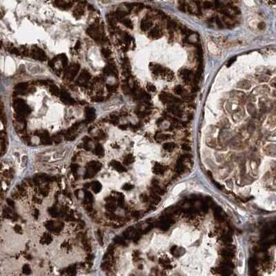 Immunohistochemistry-Paraffin: LRPPRC Antibody [NBP2-38300]