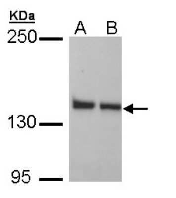 Western Blot: LRPPRC Antibody [NBP1-32744]