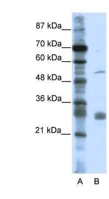 Western Blot: LRRC14 Antibody [NBP1-80049]