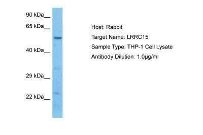Western Blot: LRRC15 Antibody [NBP1-91365]