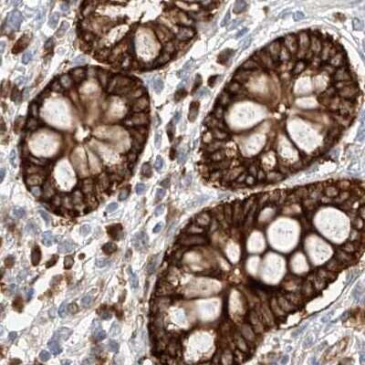 Immunohistochemistry-Paraffin: LRRC16A Antibody [NBP1-91221]