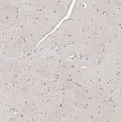 Immunohistochemistry-Paraffin: LRRC16B Antibody [NBP1-88687]