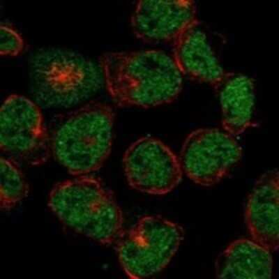 Immunocytochemistry/ Immunofluorescence: LRRC2 Antibody [NBP3-17881]