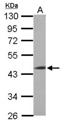 Western Blot: LRRC2 Antibody [NBP2-19374]
