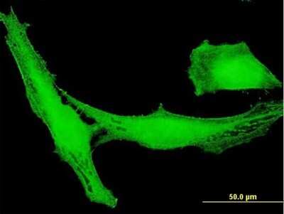 Immunocytochemistry/ Immunofluorescence: LRRC23 Antibody [H00010233-B01P]