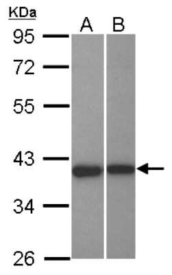 Western Blot: LRRC23 Antibody [NBP2-17170]