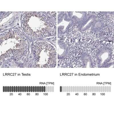 Immunohistochemistry-Paraffin: LRRC27 Antibody [NBP2-62655]