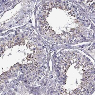 Immunohistochemistry-Paraffin: LRRC27 Antibody [NBP2-62655]
