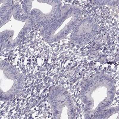 Immunohistochemistry-Paraffin: LRRC27 Antibody [NBP2-62655]