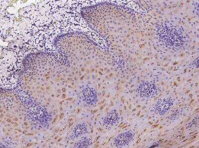 Immunohistochemistry-Paraffin: LRRC29 Antibody [NBP3-05972]