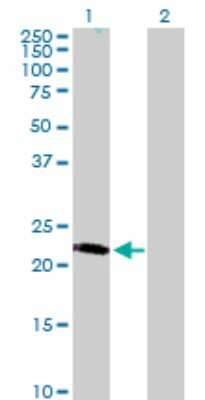 Western Blot: LRRC29 Antibody [H00026231-B01P]