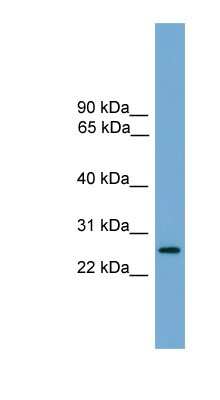 Western Blot: LRRC3 Antibody [NBP1-70624]