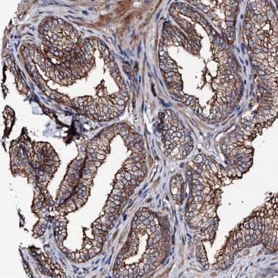 Immunohistochemistry-Paraffin: LRRC35 Antibody [NBP2-34051]