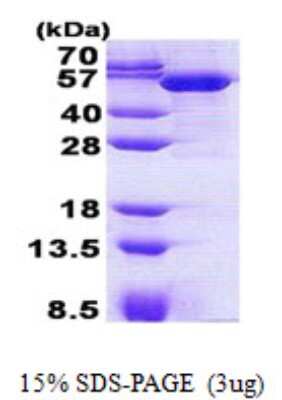SDS-PAGE: Recombinant Human LRRC35 His Protein [NBP2-22898]