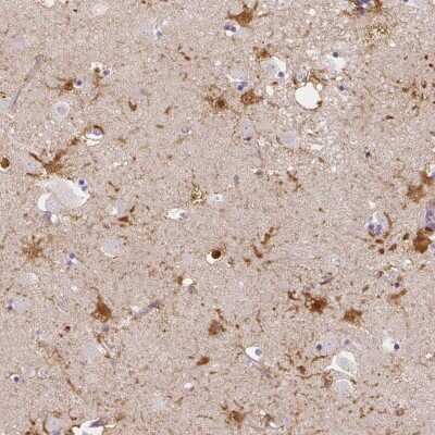 Immunohistochemistry: LRRC36 Antibody [NBP2-31597]