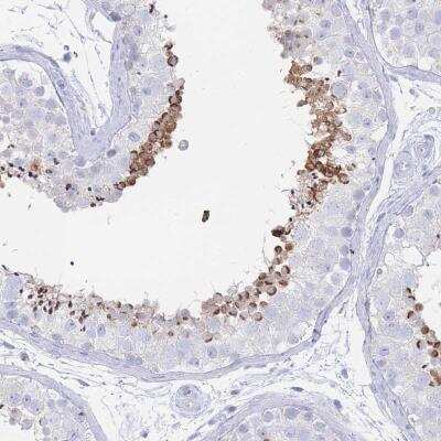 Immunohistochemistry: LRRC37A2 Antibody [NBP2-46766]