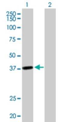 Western Blot: LRRC39 Antibody [H00127495-B01P]