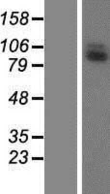Western Blot: LRRC41 Overexpression Lysate [NBP2-07629]