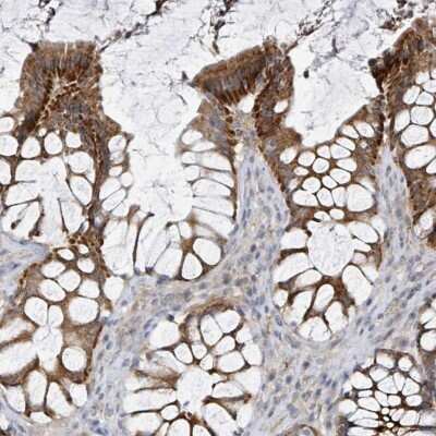 Immunohistochemistry-Paraffin: LRRC42 Antibody [NBP2-30483]
