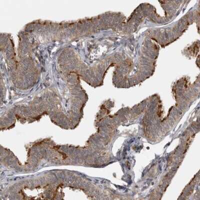 Immunohistochemistry-Paraffin: LRRC45 Antibody [NBP1-93508]