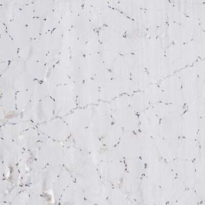 Immunohistochemistry-Paraffin: LRRC45 Antibody [NBP1-93508]