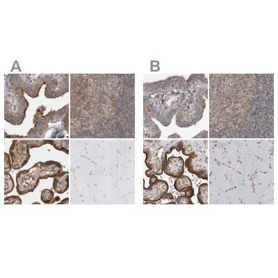 Immunohistochemistry-Paraffin: LRRC45 Antibody [NBP1-93508]