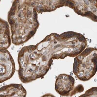 Immunohistochemistry-Paraffin: LRRC45 Antibody [NBP1-93508]