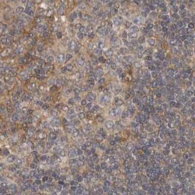 Immunohistochemistry-Paraffin: LRRC45 Antibody [NBP1-93508]