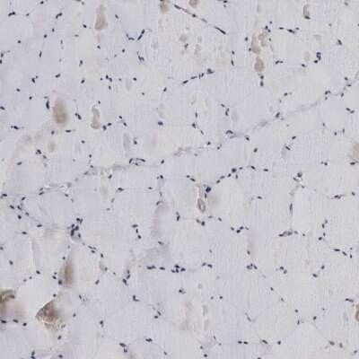 Immunohistochemistry-Paraffin: LRRC45 Antibody [NBP1-93509]