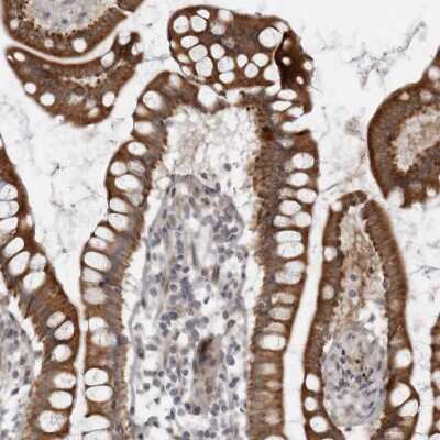 Immunohistochemistry-Paraffin: LRRC45 Antibody [NBP1-93510]
