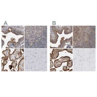 Immunohistochemistry-Paraffin: LRRC45 Antibody [NBP1-93510]
