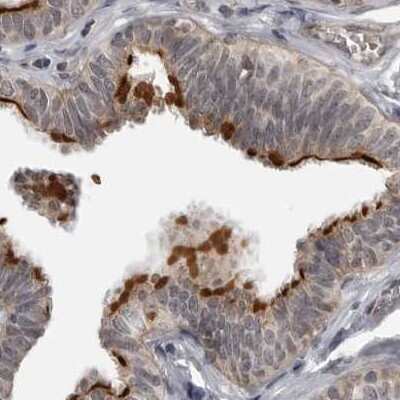 Immunohistochemistry-Paraffin: LRRC45 Antibody [NBP1-93510]
