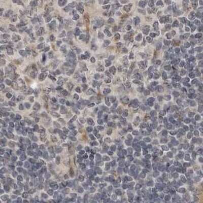 Immunohistochemistry-Paraffin: LRRC45 Antibody [NBP1-93510]
