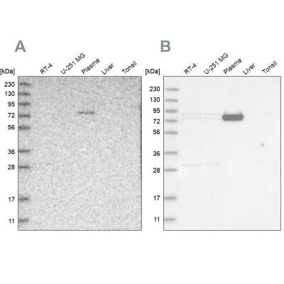 Western Blot: LRRC45 Antibody [NBP1-93509]